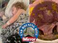 Toddler in mouldy flat contracts pneumonia as sister 'gasps for air at night'