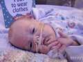 Baby born at 24 weeks weighing half a bag of sugar is 'living medical miracle'