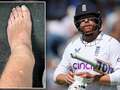 Bairstow "on the right track" for Ashes and World Cup after freak leg break eiqrtihhiqzrprw