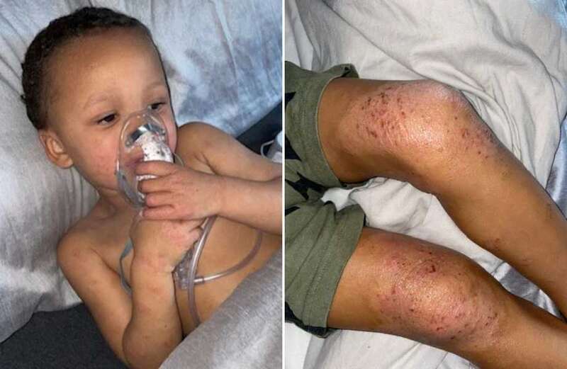 Harrowing moment boy, 4, struggles to breathe in his mould-filled home as mum begs 'I'm terrified he'll die'