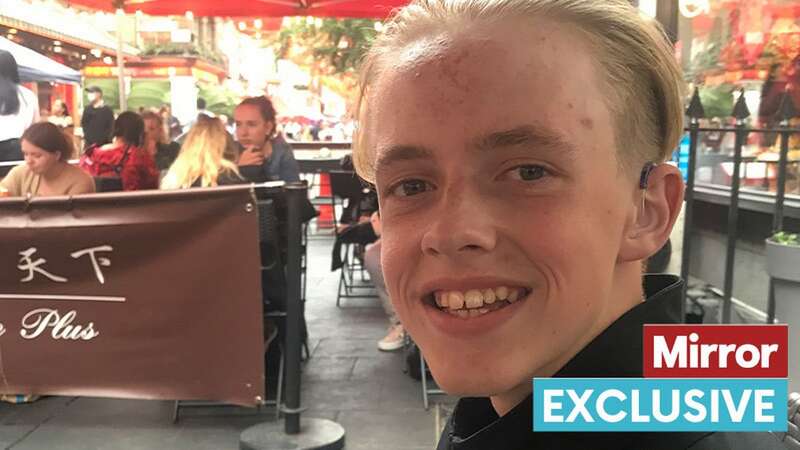 Lewis Fenwick, 15, suffered a broken eye socket, fractured nose and nerve damage to his face (Image: Daily Mirror)