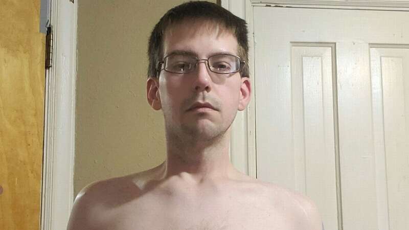 Ryan Tubbs fears he will never find love because of his breasts (Image: Kennedy News and Media)