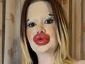 I have the ‘world’s biggest lips’ - now I’m going to set a new world record