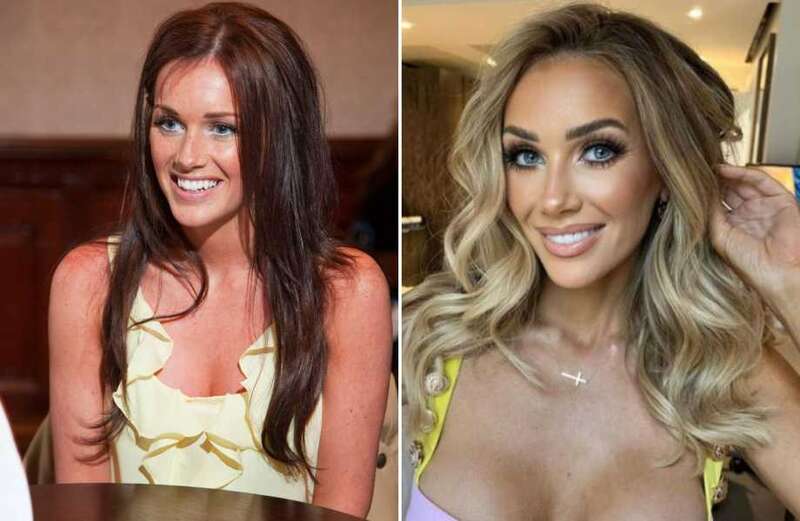 Love Island stars’ changing faces - including star's £40k makeover before show