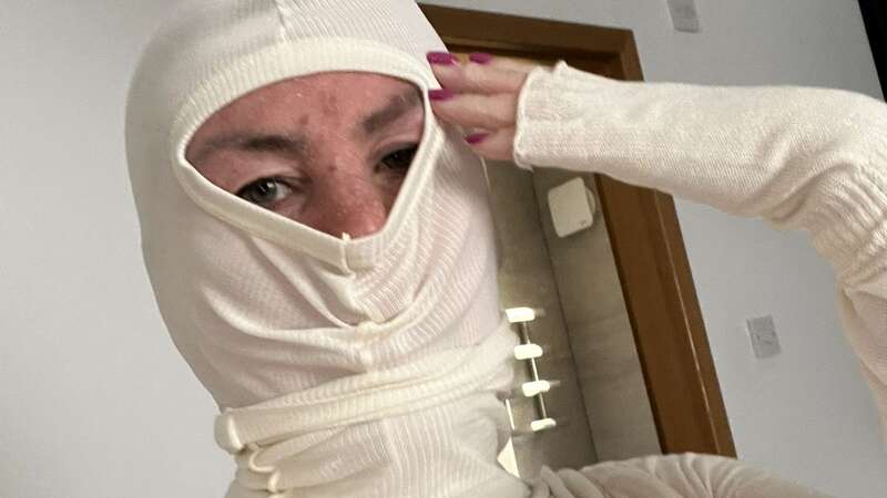 Mum Karyn Flett has resorted to wearing a balaclava to cover her painful skin after withdrawing from using steroid cream for eczema (Image: Kennedy News & Media)