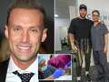 Celebrity SAS Who Dares Wins star Calum Best shows off the results of SIXTH hair transplant - using patches of his beard