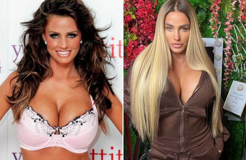 Celebrities who had liposuction: Before and after photos