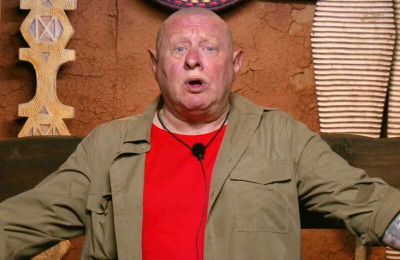 Why doesn't I'm A Celebrity star Shaun Ryder have eyelashes? Illness explained