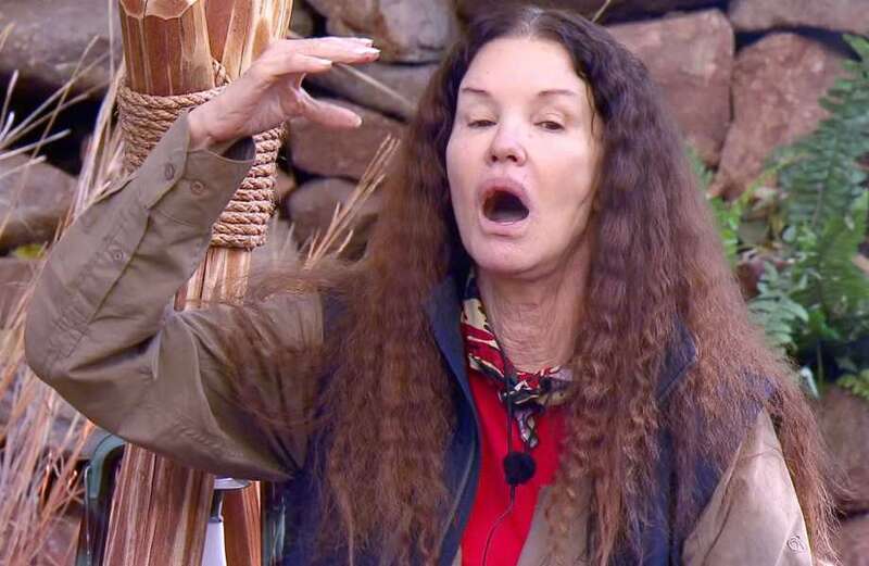 Mystery as I’m A Celebrity’s Janice and Paul fail to mention secret connection