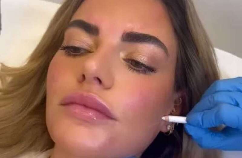 Megan Barton-Hanson has ‘facial slimming’ after quitting The Big Celebrity Detox