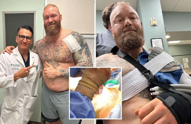 Bjornsson shows off huge scar across chest as he posts surgery video