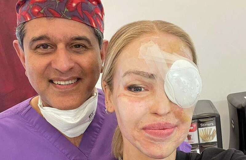 Loose Women star undergoes painful op to avoid her eye ‘perforating’