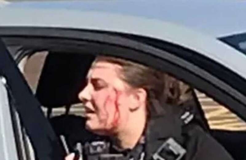 Hero cop slashed across the face after chasing wanted man in horrific attack