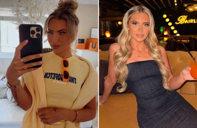 Love Island’s Mollie Salmon shows off her new face after ‘fox eye’ surgery