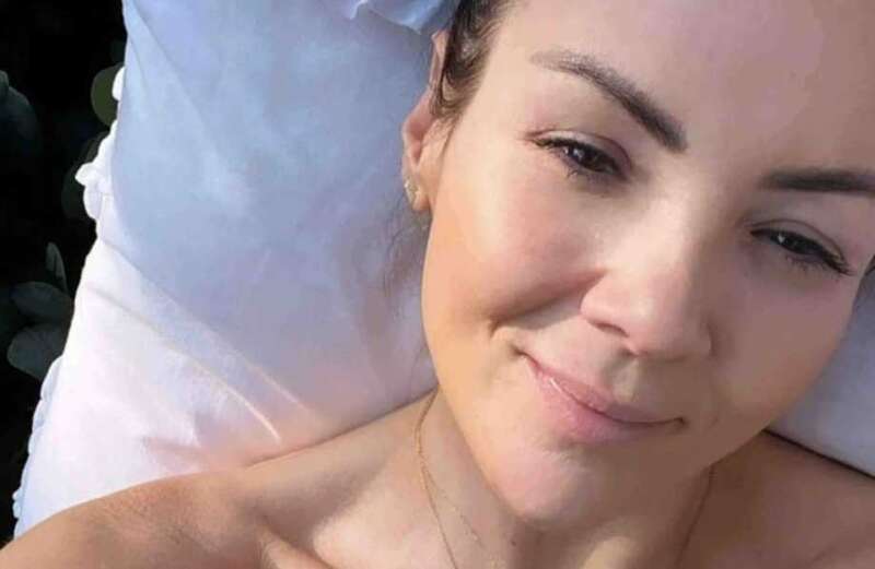 Martine McCutcheon goes 'topless' sunbathing as she reveals anxiety struggle