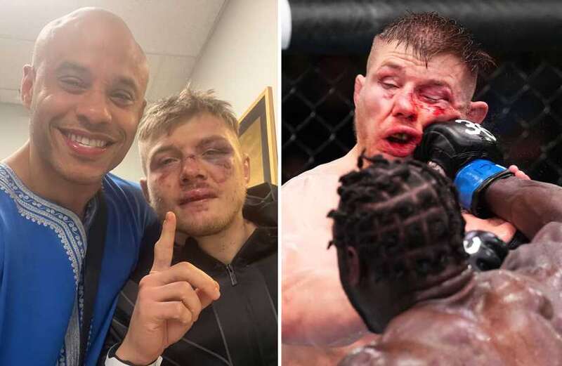 UFC star Vettori's face left unrecognisable after brutal battering by Cannonier