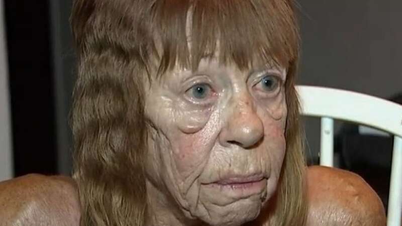 Hope, 73, has been without air conditioning for two months after hers broke down (Image: azfamily)