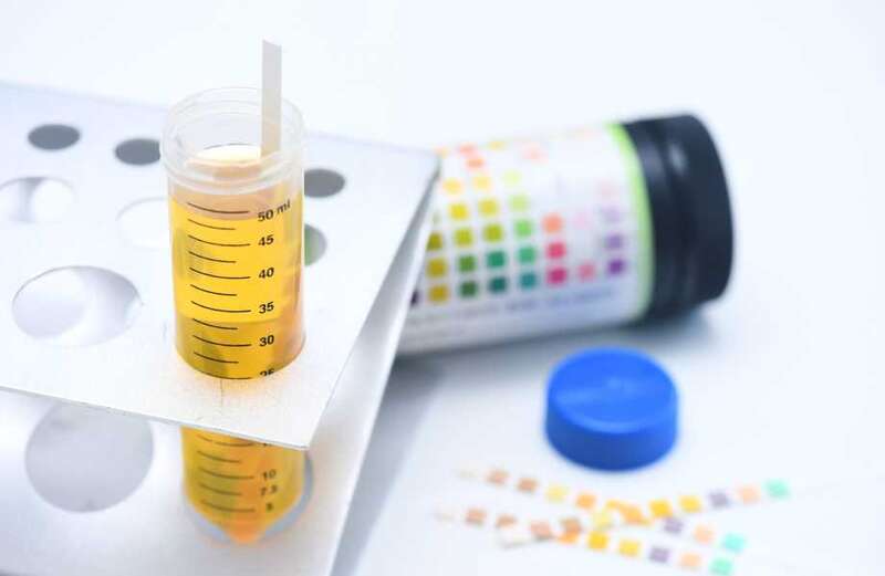 Cancer could soon be self-diagnosed with a simple 'pregnancy-style' urine test