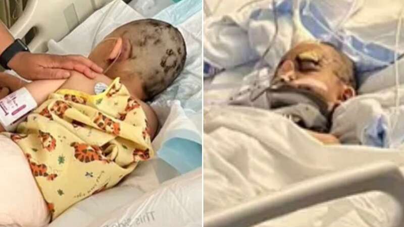 The children were pictured in hospital beds with harrowing injuries (Image: Gofundme)