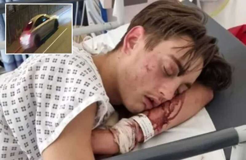 Dad of cyclist, 16, left with brain bleed after hit-and-run demands justice