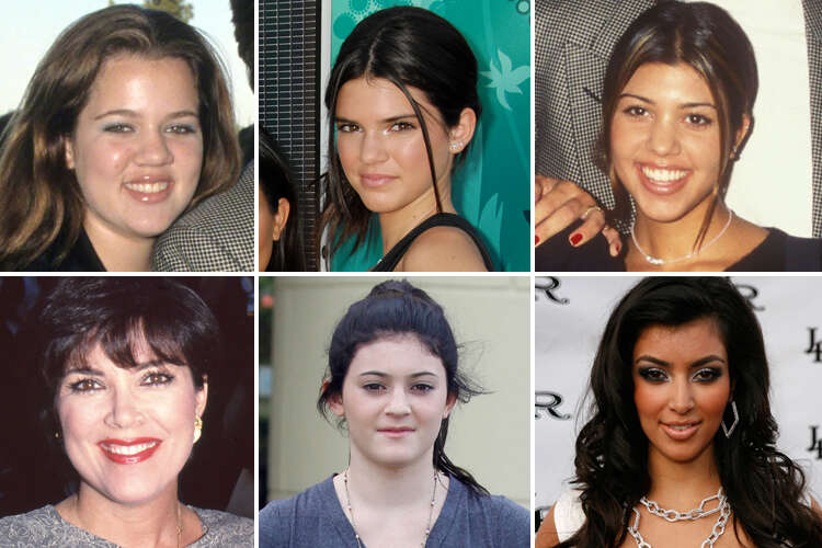 Kardashian's prove money can buy happiness with transformations