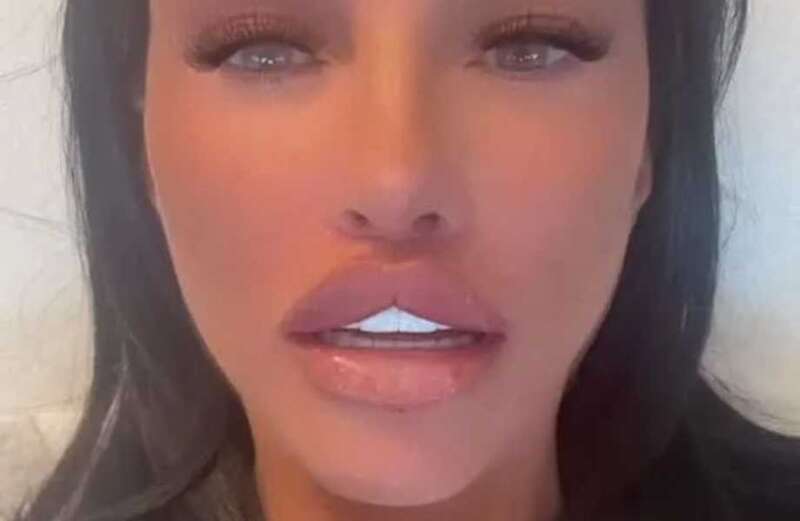 Katie Price's 'real lips revealed' - before new 'Russian doll' fillers