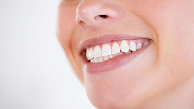 A display of shiny white teeth (Image: Getty Images)