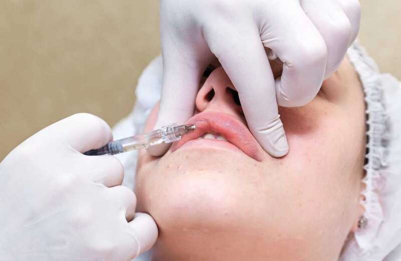 Women with fillers 'at risk of painful & disfiguring side effects years later'