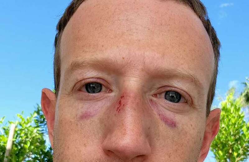 Mark Zuckerberg sports two black eyes ahead of potential Elon Musk bout