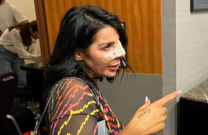 Andrew Tate spokeswoman gatecrashes 'victims' news conference with bandaged face