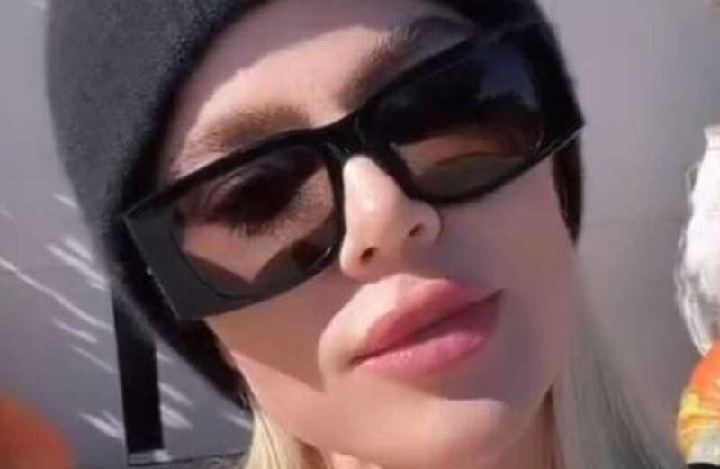 Khloe Kardashian critics gasp over star's 'botched' lips in video at mansion