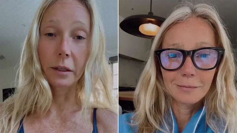 Gwyneth Paltrow has spoken candidly about her successful and unsuccessful Botox (Image: Getty Images for Daily Front Row)