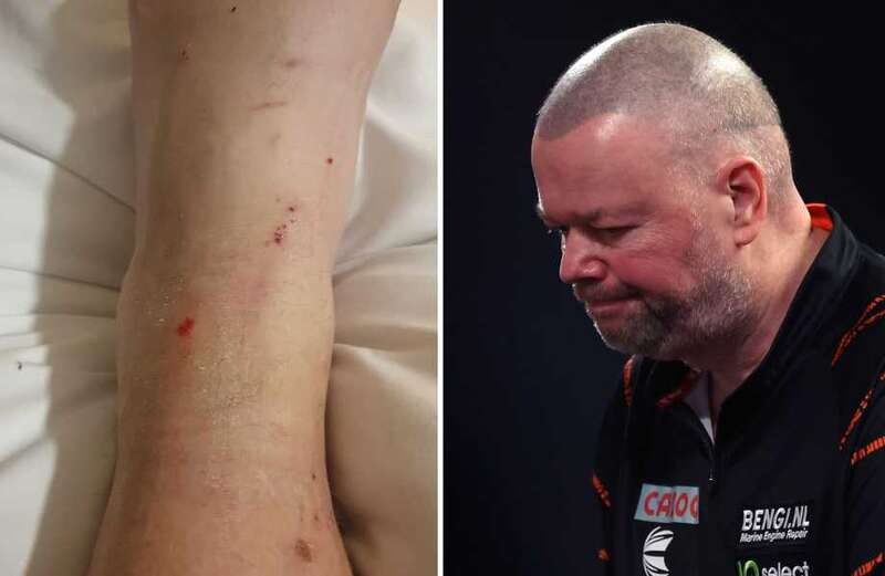 Former conqueror of Raymond van Barneveld vowed never to stay at this hotel again after his awful experience