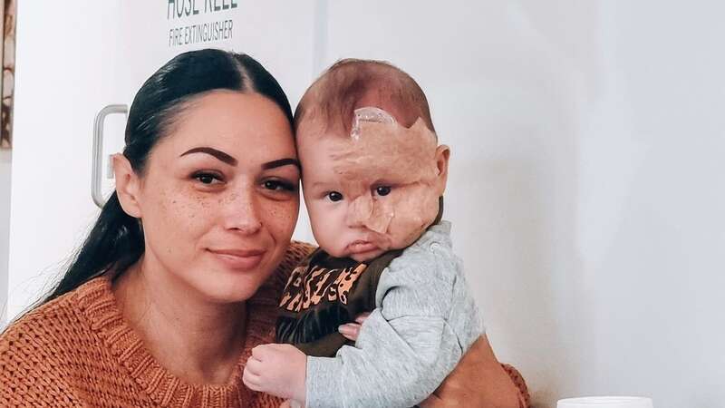 Brooke has hit back at trolls after they slammed her choice to get her son Kingsley laser treatment (Image: Jam Press/Brooke Atkins)