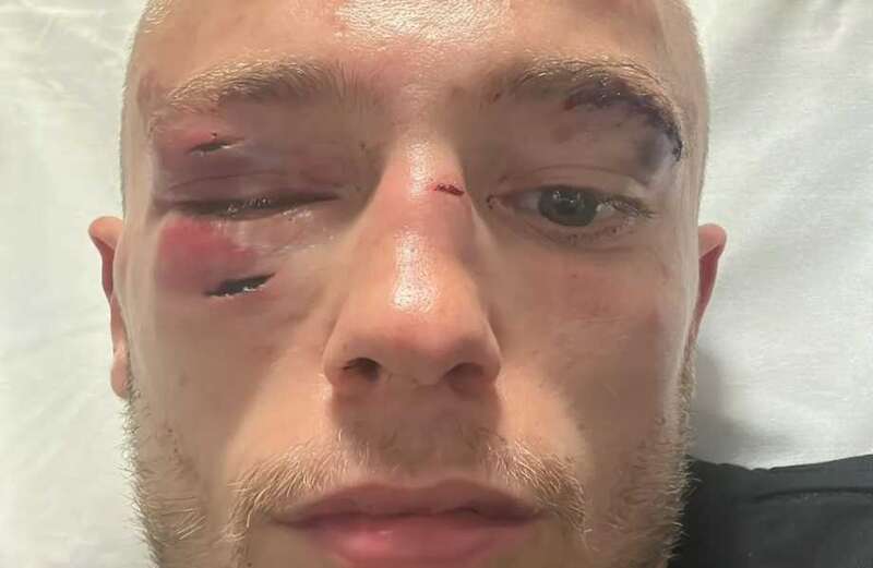 World champ looks unrecognisable with horror injuries after brutal loss