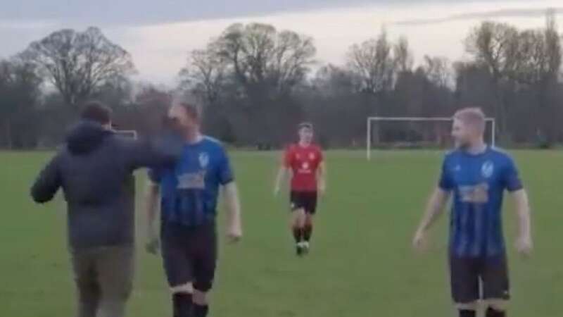 Stephen Howson was left with a black eye after a Sunday League brawl (Image: YouTube)