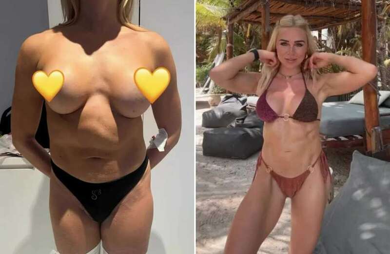 Gabby Allen reveals incredible before and after video of new boobs