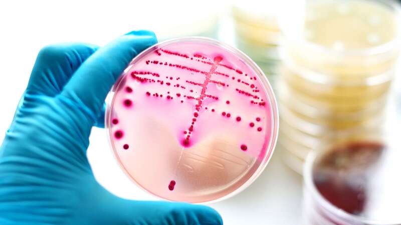 The Group A Streptococcus bacteria can be life threatening (Image: Getty Images/iStockphoto)