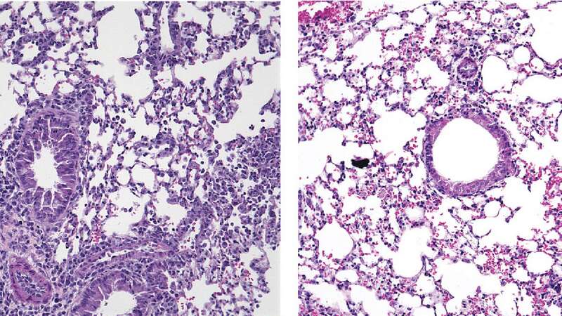 Activation of ILC2s causes inflammation in mouse lungs (left), but this is reduced by treatment with Yoda1 to stimulate Piezo1 channels (right) (Image: Hurrell et al/SWNS)