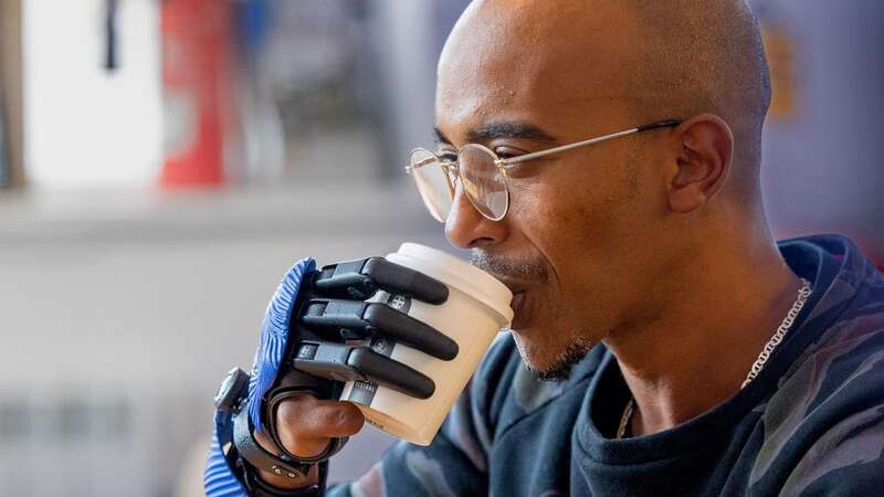 Mo Ali, 40, using his bionic fingers (Image: OpenBionics/SWNS)