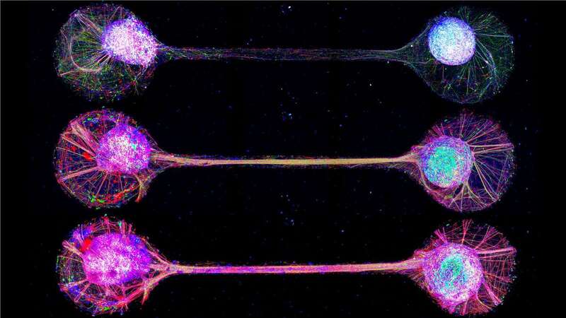 Connecting lab-grown brain cells provides insight into how our own brains work (Image: University of Tokyo/SWNS)