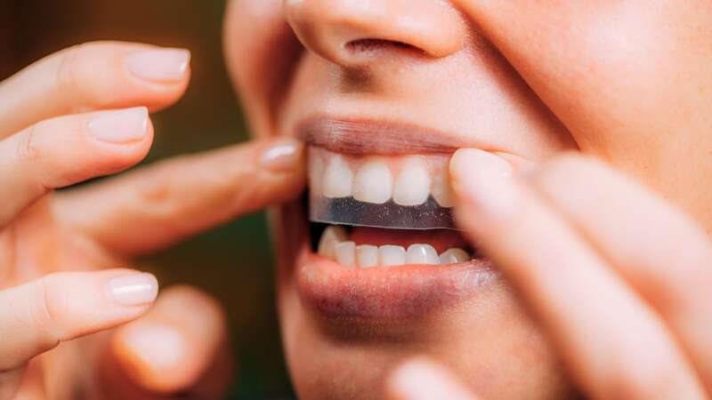 Amazon shoppers rave over dentist approved £20 teeth whitening strips that boost confidence (Image: Getty Images)