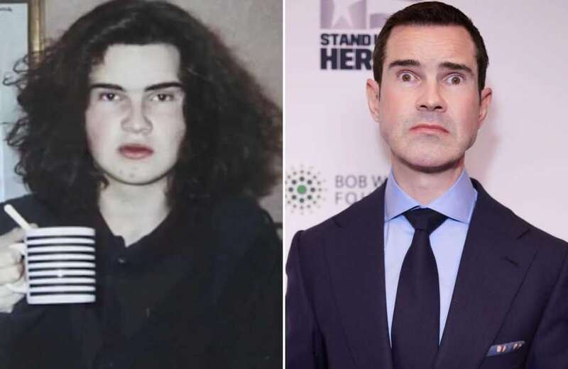 Jimmy Carr’s changing face after he admits 'little original remains'