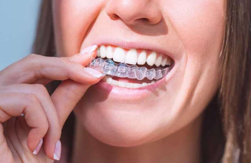 The worst at-home teeth whitening gels were found to  contain 300 times the permitted amount of hydrogen peroxide bleach