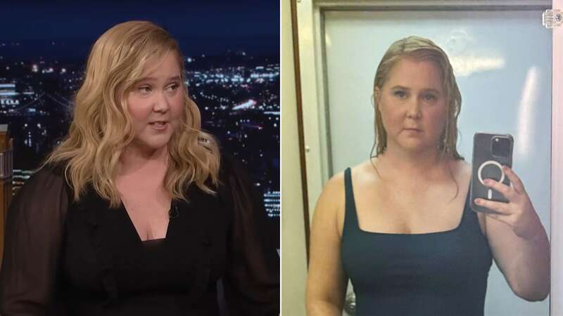 American actor Amy Schumer gets candid about her 