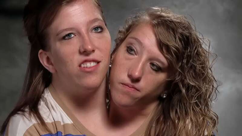 Conjoined twins Brittany and Abby admit what they argue about over shared body