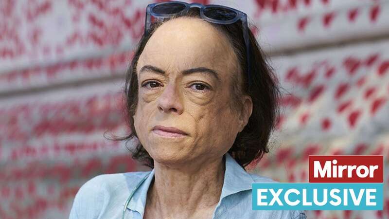 Liz Carr is fronting a new BBC show called Better Off Dead? (Image: BBC / Burning Bright Productions Ltd / Devin de Vil)