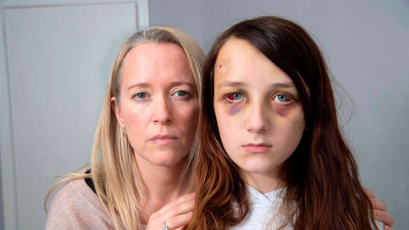 Angela Jarvis with her daughter Abbie (Image: DAILY RECORD)