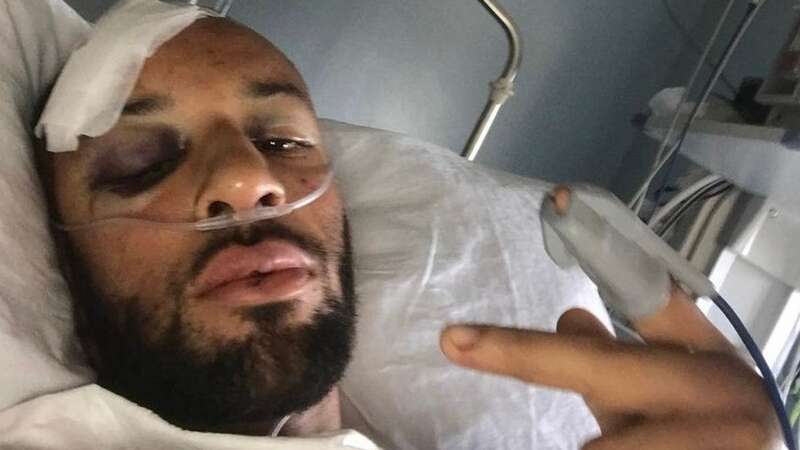 James Ellington in hospital after the crash (Image: Irwin Mitchell/SWNS)