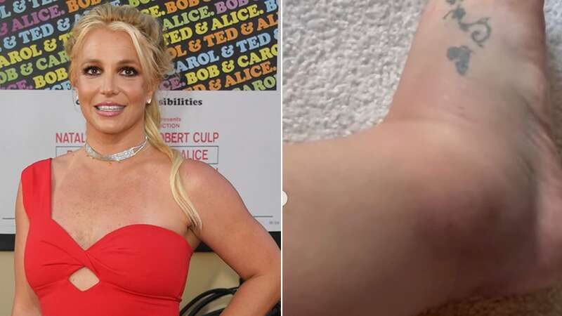 Britney previously told fans she had only twisted her ankle, slamming paramedics (Image: Instagram)